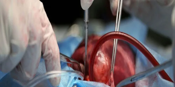 كم راتب جراح القلب في السعودية